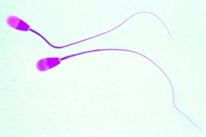 Mikropräparat -Samenfäden (Spermatozoen) vom Rind, Ausstrich