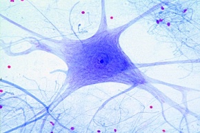 Mikropräparat - Motorische Nervenzellen. Ausstrich aus dem Rückenmark
