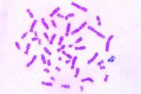 Mikropräparat - Chromosomen des Menschen im Metaphase-Stadium, ausgebreitet und einzeln identifizierbar