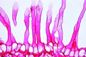 Mikropräparat - Wurzelspitze mit Wurzelhaaren, total oder Schnitt