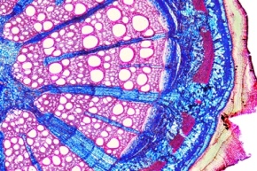 Mikropräparat - Stamm einer dikotylen Pflanze, Pfeifenstrauch (Aristolochia), drei Querschnitte verschiedenen Alters in einem Präparat