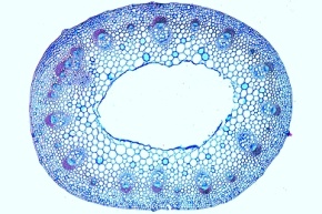 Mikropräparat - Monokotyler und dikotyler Stamm, Mais (Zea mays) und Hahnenfuß (Ranunculus), zwei Querschnitte in einem Präparat zum Vergleich