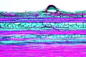 Mikropräparat - Stamm vom Flachs (Linum) mit Bastfasern, Querschnitt