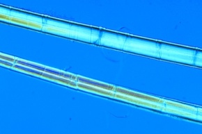 Mikropräparat - Flachs- oder Bastfasern, isoliert