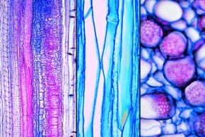 Mikropräparat - Ring-, Spiral- und Netzgefäße im Stengel vom Hahnenfuß (Ranunculus), längs