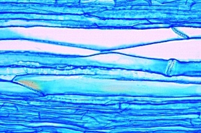Mikropräparat - Siebröhren und Leitbündel im Längsschnitt. Stamm vom Kürbis (Cucurbita), längs