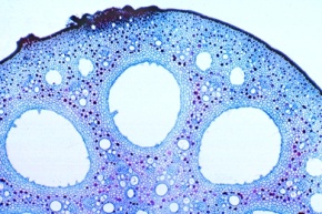 Mikropräparat - Stengel (Blattstiel) der Seerose (Nymphaea) mit inneren Sternhaaren und Lufträumen (Aerenchym), quer