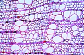 Mikropräparat - Stamm der Linde (Tilia), einjährig, mit aktivem Kambium und mehrjährig mit sekundärem Leitgewebe, zwei Querschnitte zum Vergleich