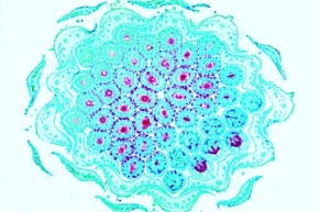 Mikropräparat - Blüte vom Löwenzahn (Taraxacum), quer, Kompositenblüte