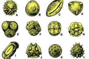 Mikropräparat - Pollentypen, Streupräparat, viele verschiedene Typen