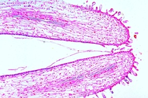 Mikropräparat - Narbe mit einwachsenden Pollen von Eschscholtzia, total oder längs