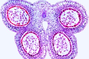 Mikropräparat - Reifer Staubbeutel der Lilie (Lilium), quer, Pollenkammern und reife Pollenkörner