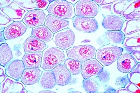 Mikropräparat - Junger Staubbeutel der Lilie (Lilium), quer, Meiotische Reifeteilungen der Pollenmutterzellen (Prophase Stadien)