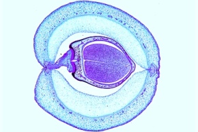 Mikropräparat - Hülse mit Samenanlagen der Bohne (Phaseolus), quer