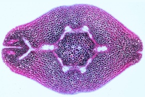 Mikropräparat - Samen der Sonnenblume (Helianthus), quer. Achaene