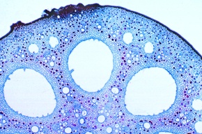 Mikropräparat - Seerose (Nymphaea), Blattstiel mit Luftkanälen, quer