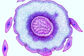 Mikropräparat - Lycopodium, Bärlapp, Stamm mit Plectostele, quer, Bärlappgewächse (Lycopodiatae)