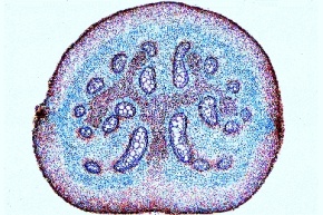 Mikropräparat - Pteridium, Adlerfarn, Rhizom mit Polystele, quer, Farne (Filicatae)