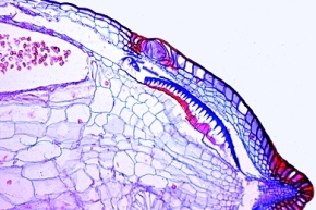 Mikropräparat - Polytrichum, Haarmoos, Sporenkapsel mit Sporen, längs