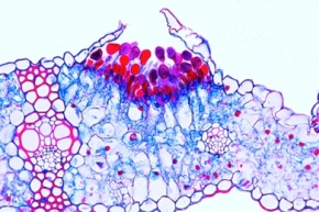 Mikropräparat - Puccinia graminis, Getreiderost, Uredosporen auf Getreideblatt, quer, Ständerpilze (Basidiomycetes)