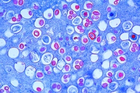 Mikropräparat - Tuber rufum, Trüffel, Fruchtkörper mit Asci, quer, Schlauchpilze (Ascomycetes)