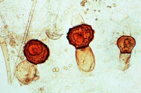 Mikropräparat - Rhizopus nigricans, Myzel mit Konjugationsstadien und Zygotenbildung, total, Algenpilze (Phycomycetes)