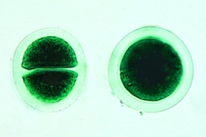 Mikropräparat - Chroococcus, einzellige Blaualge, total, Blaugrüne Algen (Cyanophyceae)