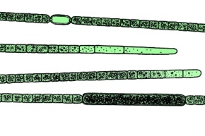 Mikropräparat - Aphanizomenon, Sichelalge, mit Heterocysten, total, Blaugrüne Algen (Cyanophyceae)