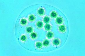 Mikropräparat - Pandorina morum, koloniebildende Geißelalge mit Gallerthülle, total, Grünalgen (Chlorophyceae)
