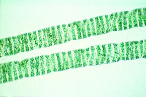 Mikropräparat - Spirogyra, Schraubenalge, vegetative Fäden, total, Jochalgen (Conjugatae)