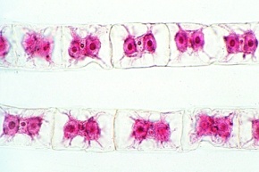 Mikropräparat - Zygnema, Fadenalge mit sternförmigen Chloroplasten, total, Jochalgen (Conjugatae)