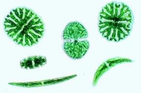 Mikropräparat - Zieralgen (Desmidiaceen), Streupräparat mit verschiedenen Arten, Jochalgen (Conjugatae)