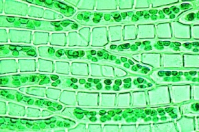 Mikropräparat - Sphagnum, Torfmoos, Blatt in Aufsicht: Chlorphyll- und Wasserzellen