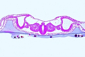 Mikropräparat - Huhn, 3 Tage alter Keim, quer: Amnion und Serosa, Myotom, Nierenanlage, Aorta, extraembryonales Gefäßsystem