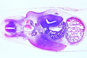 Mikropräparat - Huhn, Querschnitt durch die Herzregion eines 4 - 5 Tage alten Embryos