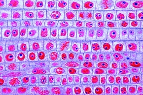 Mikropräparat - Zellteilungen (Mitosen) im Längsschnitt durch die Wurzelspitze der Zwiebel (Allium). Beispiel für Zellteilungen