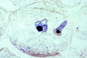 Mikropräparat - Ascaris, Eindringen der Spermatozoen in die Eizellen