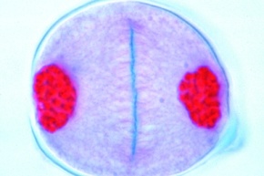 Mikropräparat - Lilie, Telophase der ersten und Prophase der zweiten (homöotypischen) Reifungsteilung