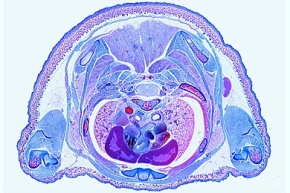 Mikropräparat - Embryo vom Schwein, 15 mm, Querschnitt durch den Thorax