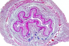 Mikropräparat - Speiseröhre (Oesophagus), Mensch, quer