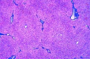 Mikropräparat - Leber, Mensch, quer