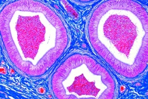 Mikropräparat - Nebenhoden (Epididymis), Mensch, quer