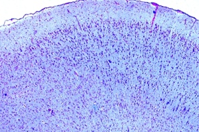 Mikropräparat - Großhirnrinde, Mensch, quer