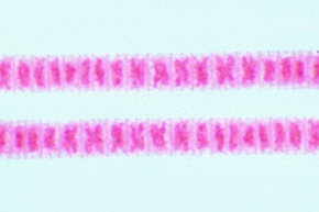 Mikropräparat - Oscillatoria, fadenförmige Blaualge, total