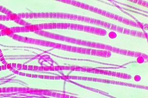 Mikropräparat - Rivularia, Kalkkrusten-Blaualge