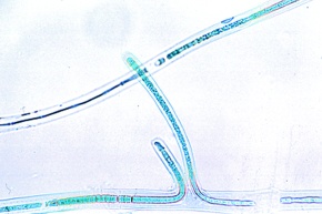 Mikropräparat - Scytonema, fadenförmige Blaualge, mit Scheinverzweigungen