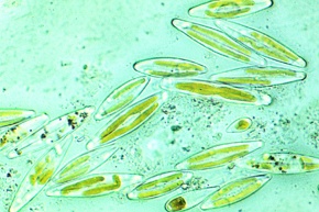 Mikropräparat - Süßwasserdiatomeen , Färbung der Chromatophoren