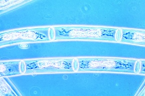 Mikropräparat - Mougeotia, plattenförmige Chloroplasten
