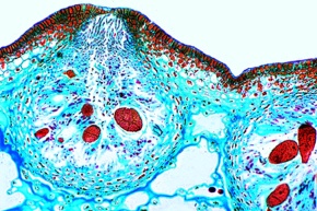 Mikropräparat - Fucus vesiculosus, weibliches Konzeptakel mit Oogonien, quer