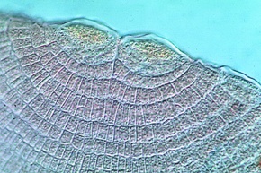 Mikropräparat - Dictyota dichotoma, Gabeltang, Thallus mit Tetrasporen, Schnitt *